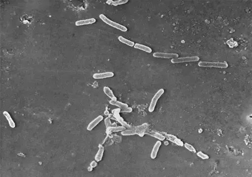 This scanning electron microscope image made available by the Centers for Disease Control and Prevention shows rod-shaped Pseudomonas aeruginosa bacteria. U.S. officials are reporting two more deaths and additional cases of vision loss linked to eyedrops tainted with the drug-resistant bacteria. The eyedrops from EzriCare and Delsam Phama were recalled in February 2023 and health authorities are continuing to track infections as they investigate the outbreak. (Janice Haney Carr/Centers for Disea