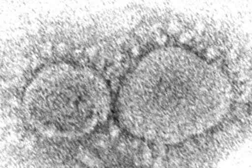 This 2020 electron microscope image made available by the Centers for Disease Control and Prevention shows SARS-CoV-2 virus particles which cause COVID-19. The coronavirus mutant that just became dominant in the United States as of May 2022 is a member of the omicron family. But scientists say it spreads faster than its omicron predecessors, is adept at escaping immunity and might possibly cause more serious disease. (Hannah A. Bullock, Azaibi Tamin/CDC via AP, File)