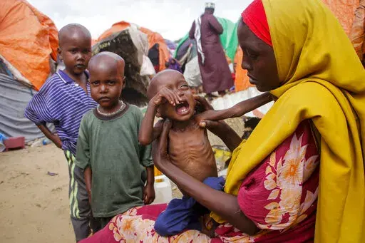 Maryan Madey, who fled the drought-stricken Lower Shabelle region, holds her malnourished daughter Deka Ali, 1, at a camp for the displaced on the outskirts of Mogadishu, Somalia Saturday, Sept. 3, 2022. Millions of people in the Horn of Africa region are going hungry because of drought, and thousands have died, with Somalia especially hard hit because it sourced at least 90 percent of its grain from Ukraine and Russia before Russia invaded Ukraine. (AP Photo/Farah Abdi Warsameh)